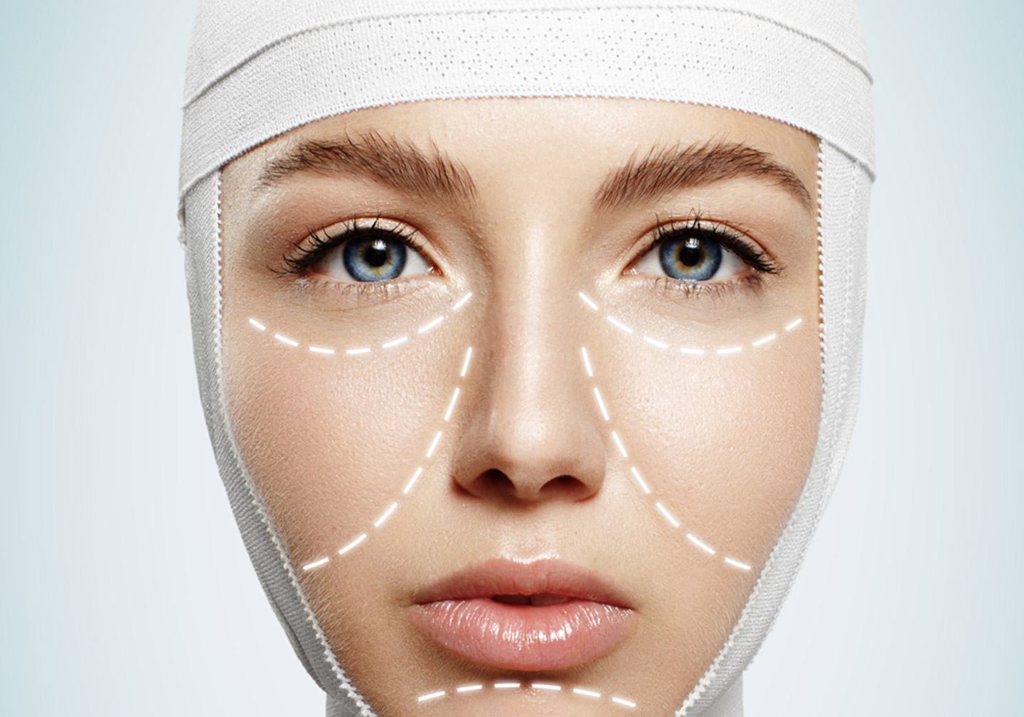 MEDITOUS × Target Plastic Surgery, One-Day V-Line Promotion Launch's image