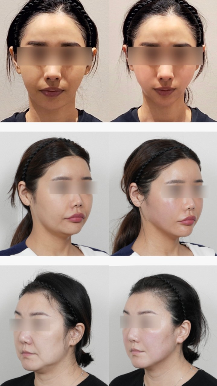 브이에스(VS)의원's Image