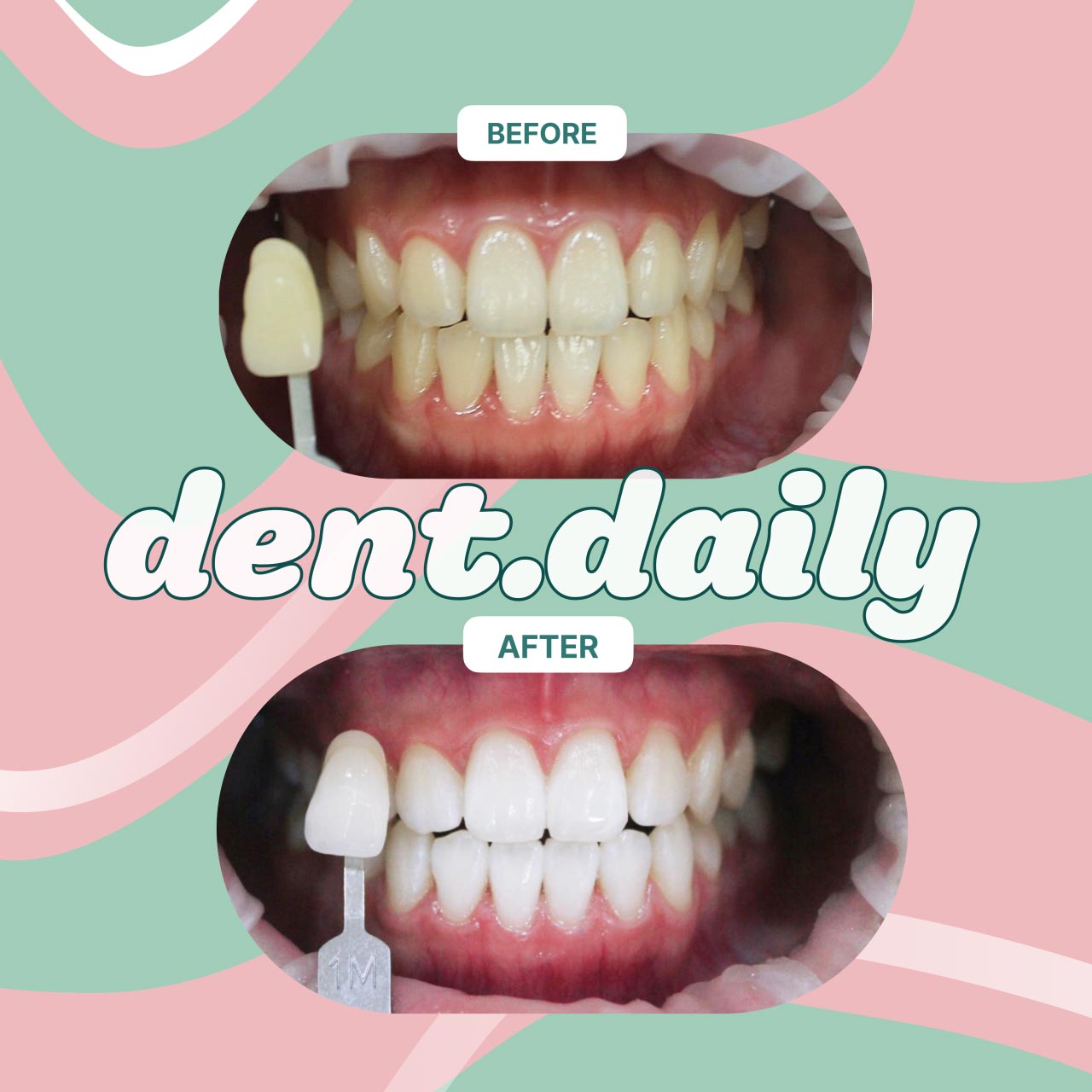 종로30분치과의원's Image