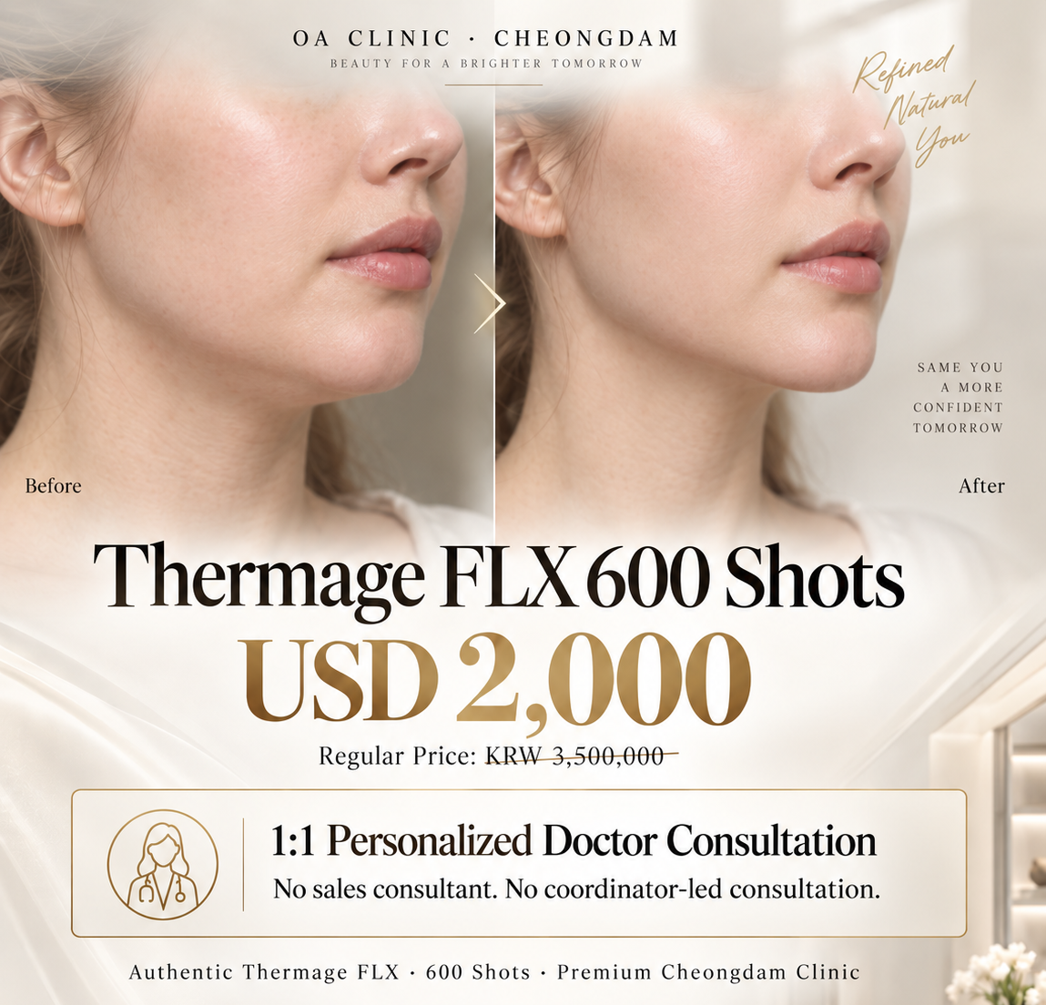 The OA Thermage FLX 600 Shots's image